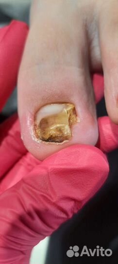 Услуги подолога