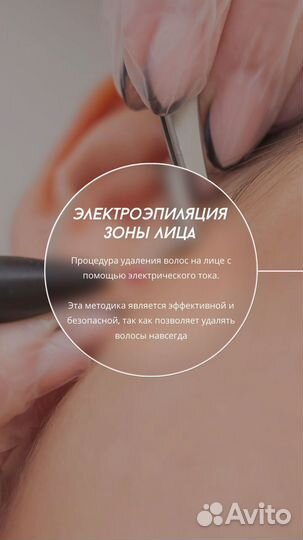 Электроэпиляция