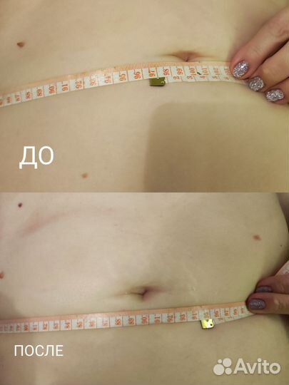 Аппаратный массаж, коррекция фигуры, чистки лица