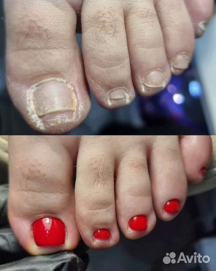 Педикюр в салоне