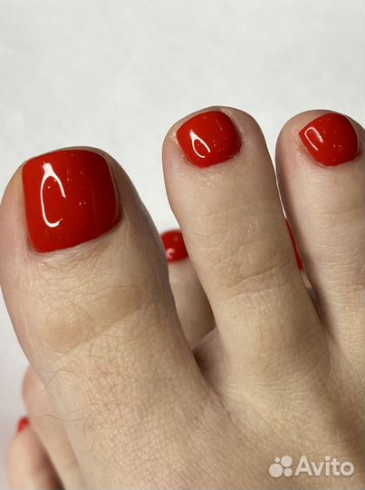 Коррекция вросшего ногтя