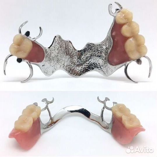Протезирование зубов с выездом на дом