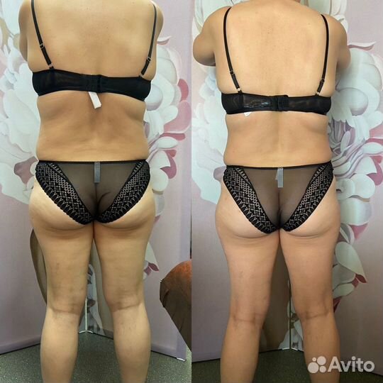 Корректирующий массаж