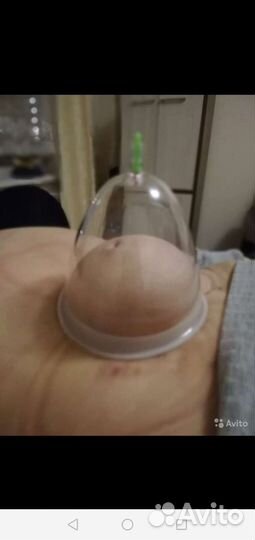 Вакуумные банки