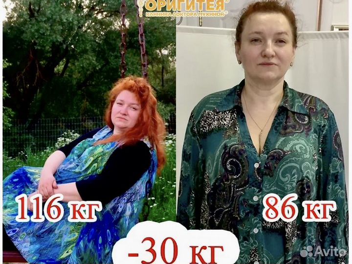 Снижение веса/ Комплексное похудение