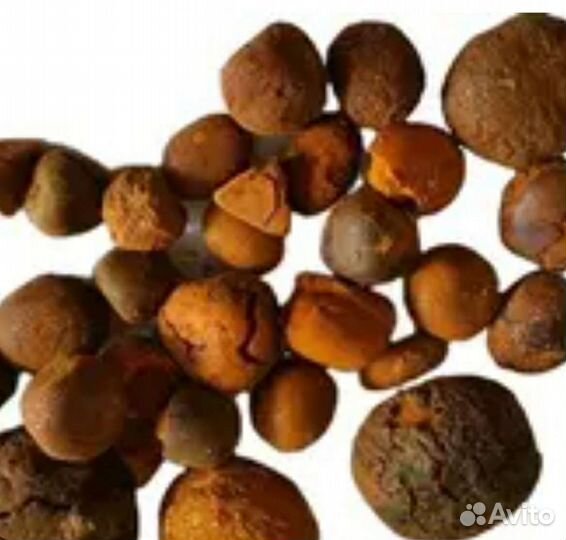 Камень желчного пузыря крс