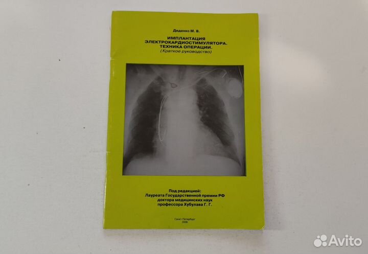 Имплантация электрокардиостимулятора.Диденко М.В