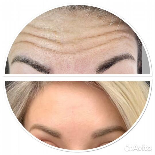 Массаж лица, косметолог