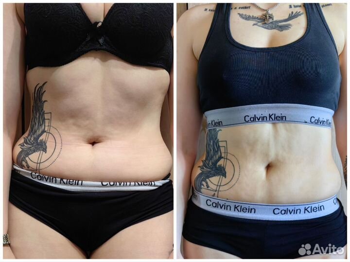 Вибромассаж