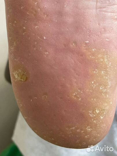 Требуются модели бесплатно