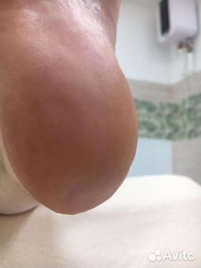 Smart педикюр