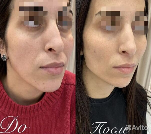 Скульптурирование лица(обучение)