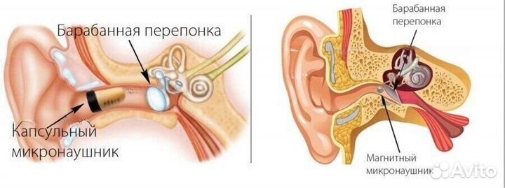 Микронаушники