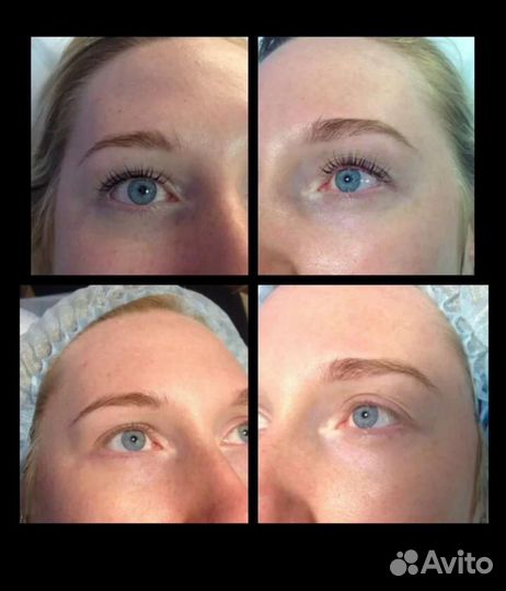 Ламинирование и ботокс ресниц, бровей