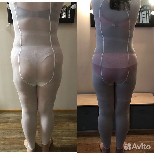 LPG массаж на оригинальном аппарате vortex