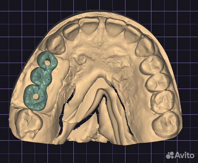 Моделировка в Exocad/Оператор cadcam