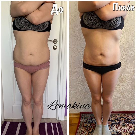 Массаж коррекция фигуры для женщин