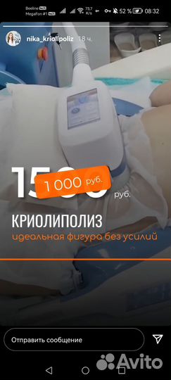 Криолиполиз