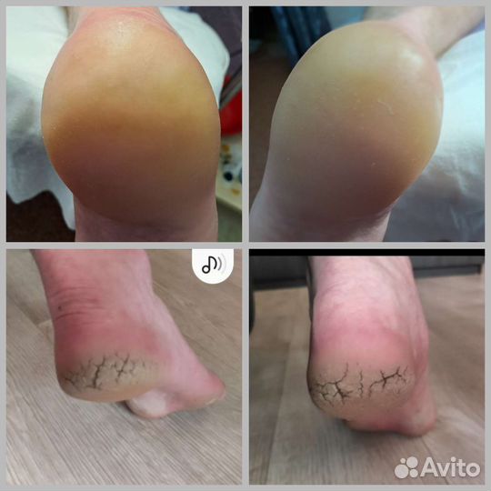 Педикюр мужской