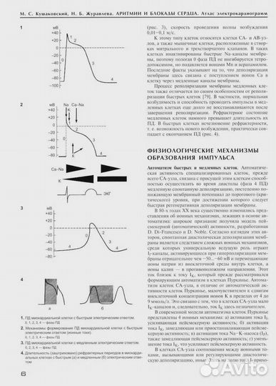 Аритмии и блокады сердца: атлас электрокардиограмм