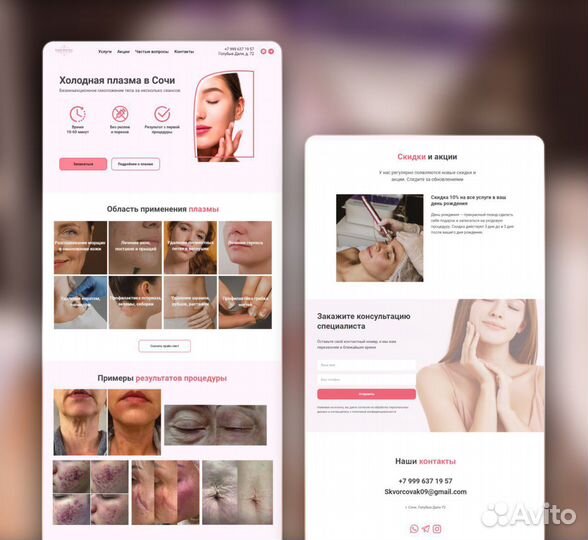 Создание сайта на Тильде / Разработка лендинга