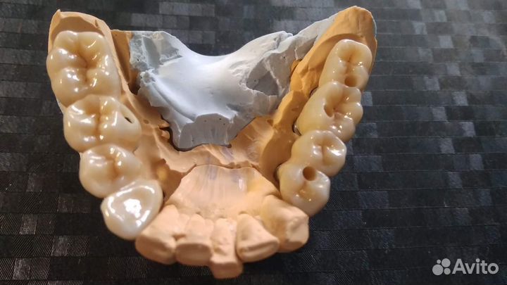 Услуги зубного техника