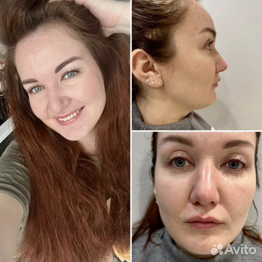 Врач косметолог