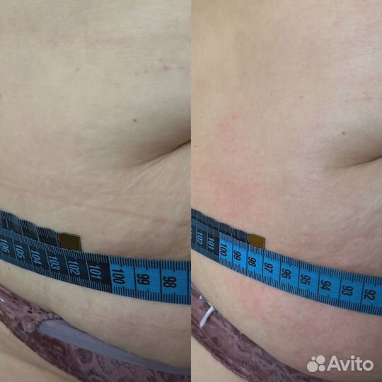 Чистка лица, наращивание ресниц