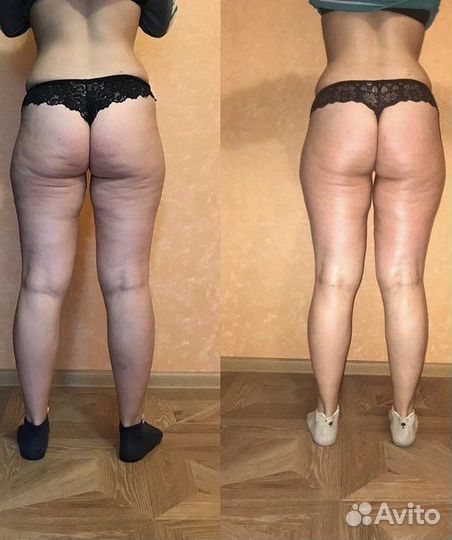 Коррекция, массаж, выезд на дом