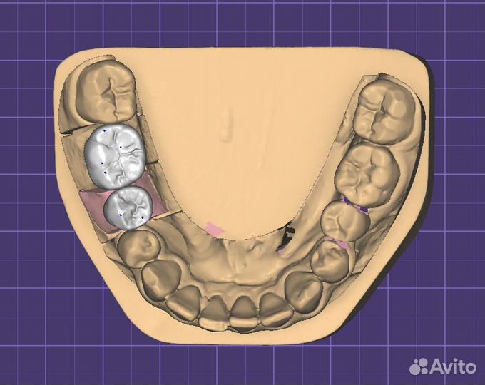Моделировка в Exocad/Оператор cadcam