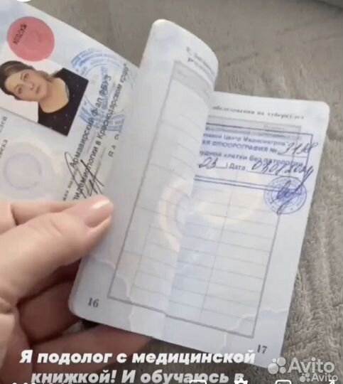 Коррекция вросшего ногтя