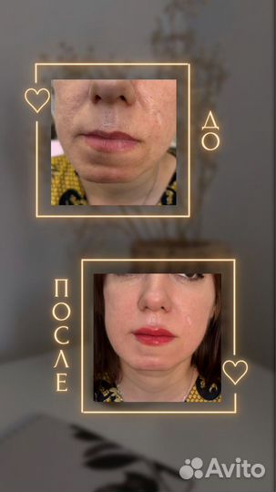 Перманентный макияж