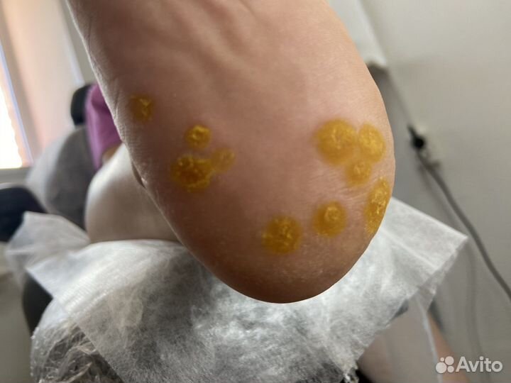 Подолог, мастер педикюра