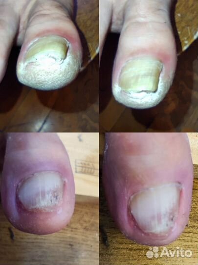 Смарт педикюр. Метро звёздная