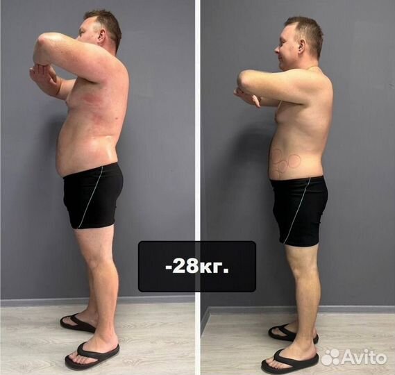 Аппаратный массаж. Антицеллюлитный. Коррекция фигу