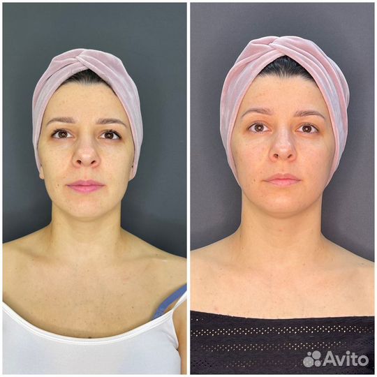 Массаж лица