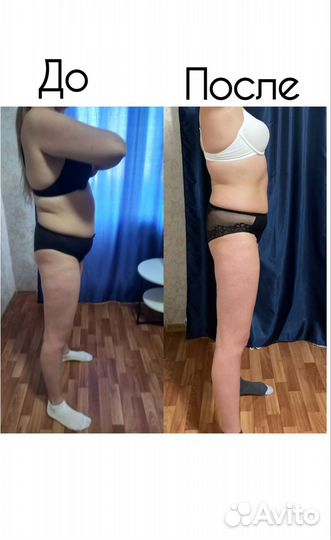 Антицеллюлитный массаж/Классический массаж