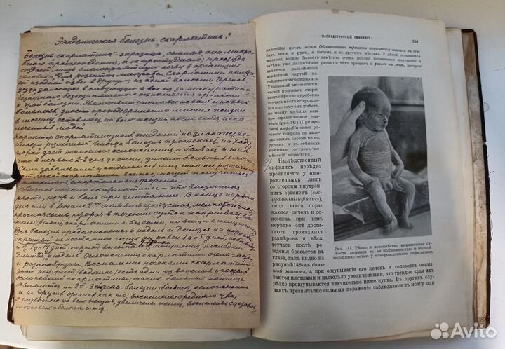 Курс детских болезней