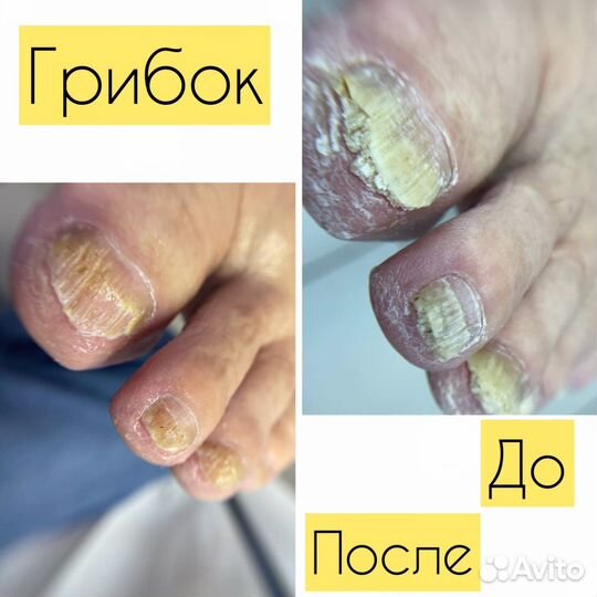 Подолог/ педикюр