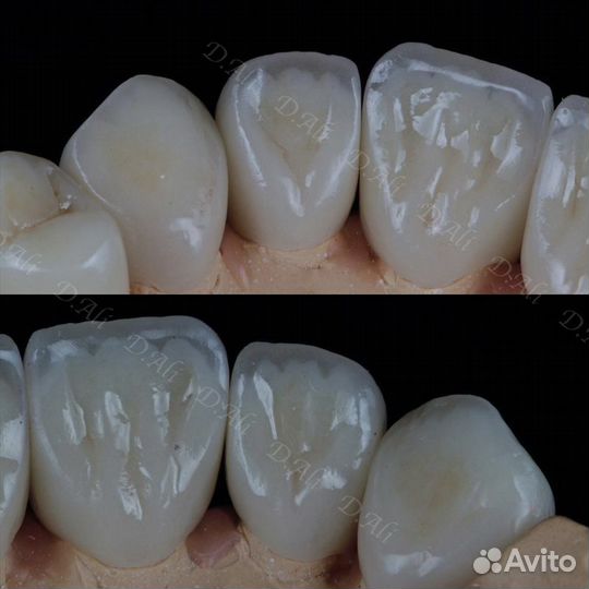 Зубной техник услуги