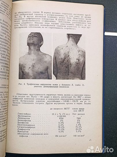 Биоэлектрическая активность головного мозга 1971