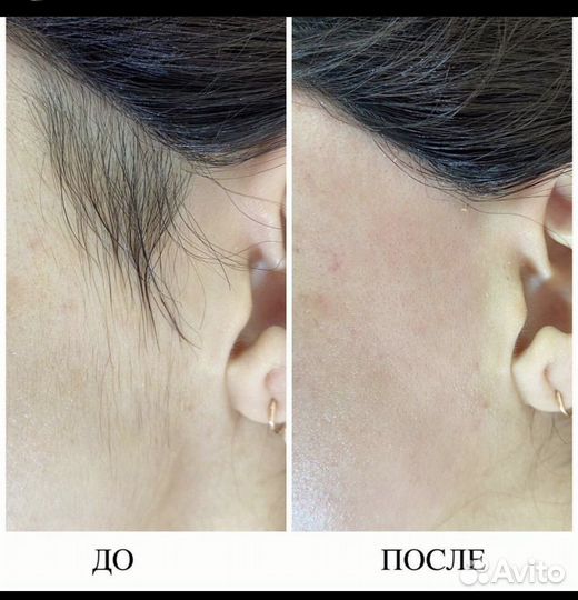 SPA-шугаринг,восковая депиляция, коррекция бровей