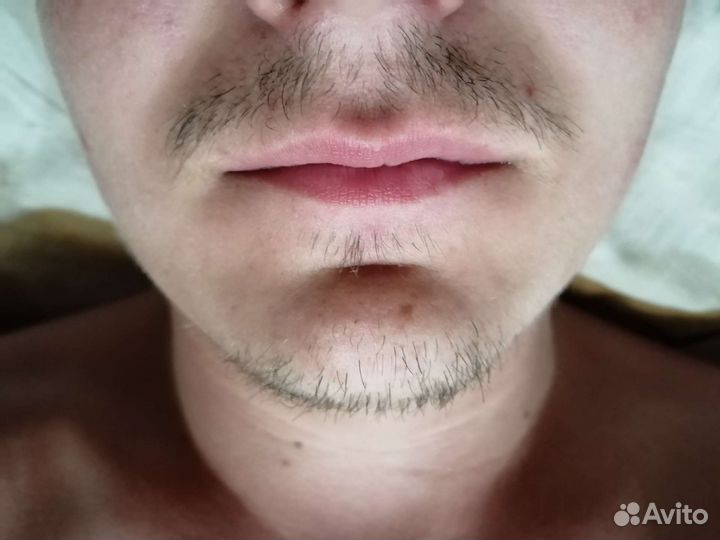 Депиляция воском: глубокое бикини