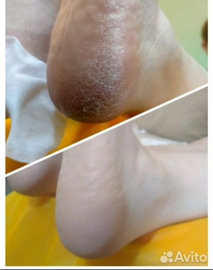 Маникюр и педикюр на дому