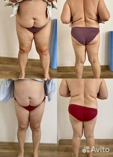 Массаж коррекция фигуры