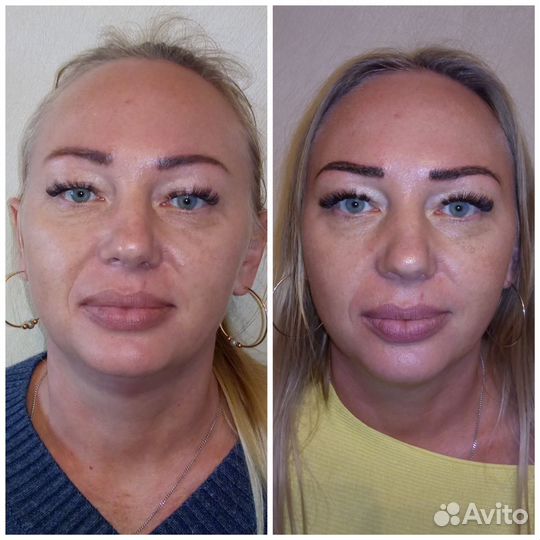 Массаж антицеллюлитный,мадейратерапия,классический