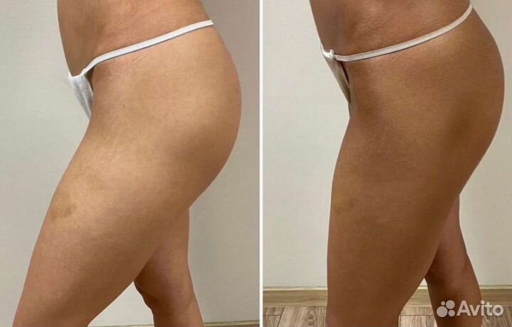 Моментальный загар Приморский район СПб