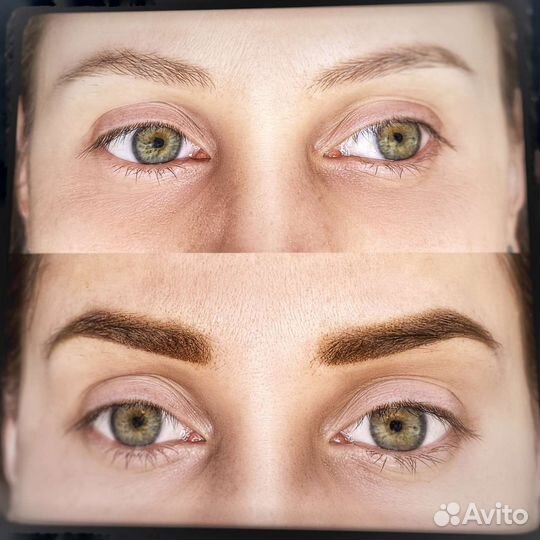 Татуаж бровей, губ, веки. Удаление татуажа