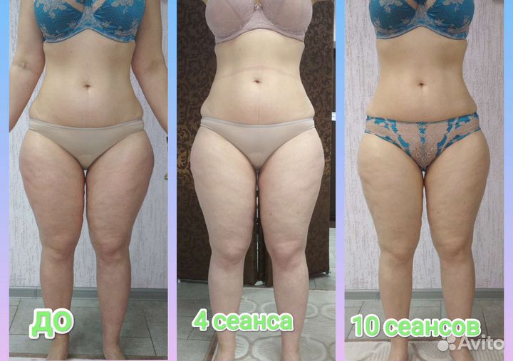 Антицеллюлитный массаж