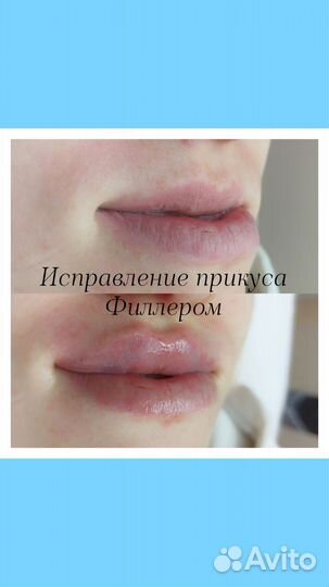 Обучение эстетической косметологии и инъекционной